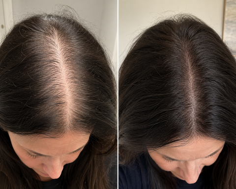 Hair XT Hair Growth Serum | All-Natural Hair Growth Oil That Gets